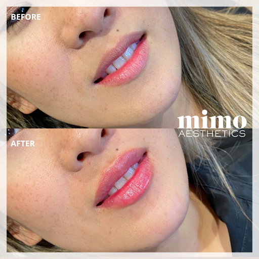 mimo aesthetics image