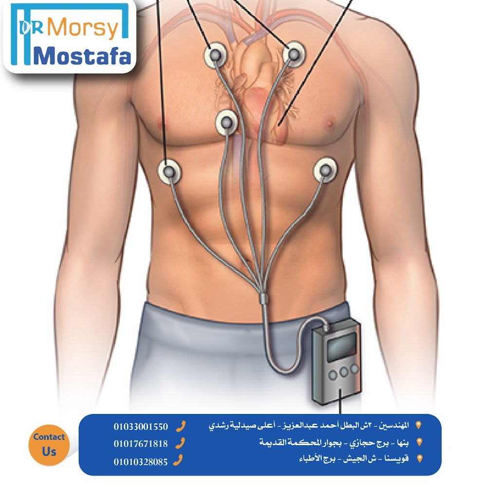 دكتور مرسي مصطفي لأمراض القلب والقسطرة العلاجية