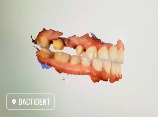 Dentista Matamoros Dr. Alfredo Castañeda -DactiDent-