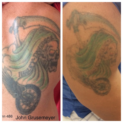 Explore manifestation tattoo ideas, creative tattoo ideas in Naples, available at Laser Tattoo Removal Services