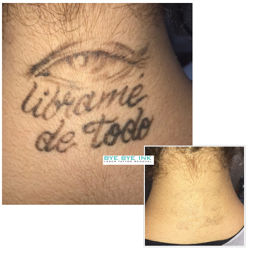 Explore couple tattoo ideas minimalist, creative tattoo ideas in Middle Village, available at Bye Bye Ink Laser Tattoo Removal