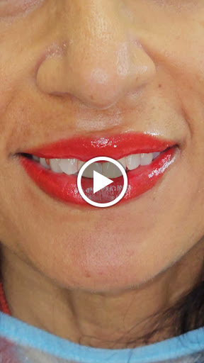 Explore heart surgery tattoo ideas, creative tattoo ideas in Clearwater, available at FACE NAKED STUDIO, PERMANENT MAKEUP ACADEMY AND SPA