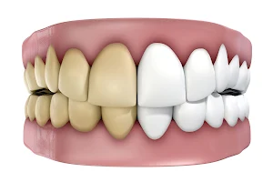 Quality Dentistry - Best Dentist, Invisalign Clear Aligners Specialist, Root Canal, Dental Implants, Kids Dental Clinic image