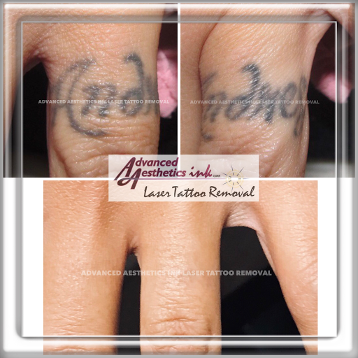 Explore wyoming tattoo ideas, creative tattoo ideas in South Dartmouth, available at Advanced Aesthetics Ink Laser Tattoo Removal