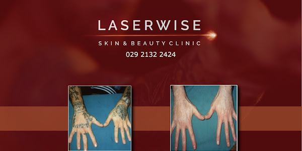 LaserWise Clinic
