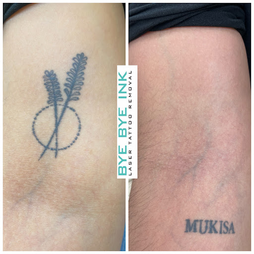 Explore tattoo father daughter ideas, creative tattoo ideas in Middle Village, available at Bye Bye Ink Laser Tattoo Removal