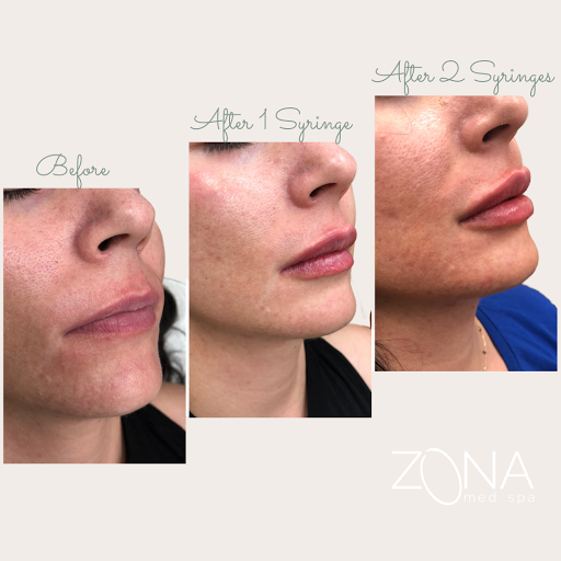 Skin Care Clinic «ZONA MED SPA», reviews and photos, 9767 N 91st St #102, Scottsdale, AZ 85258, USA