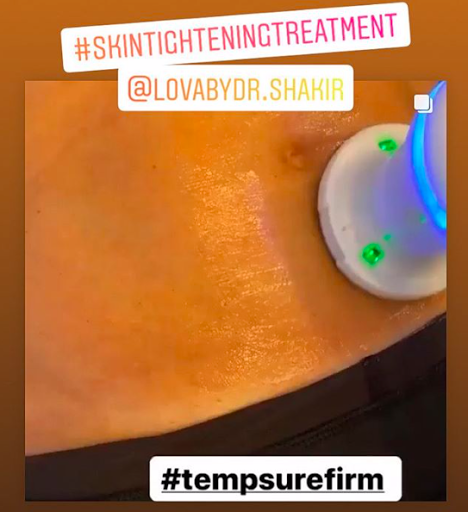 Find tattoo ideas for woman on leg for your next unique tattoo in Lake Oswego at Lake Oswego Vein and Aesthetic LOVA