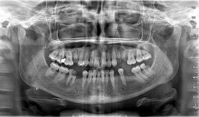 الاطباء للاشعة الاسنان