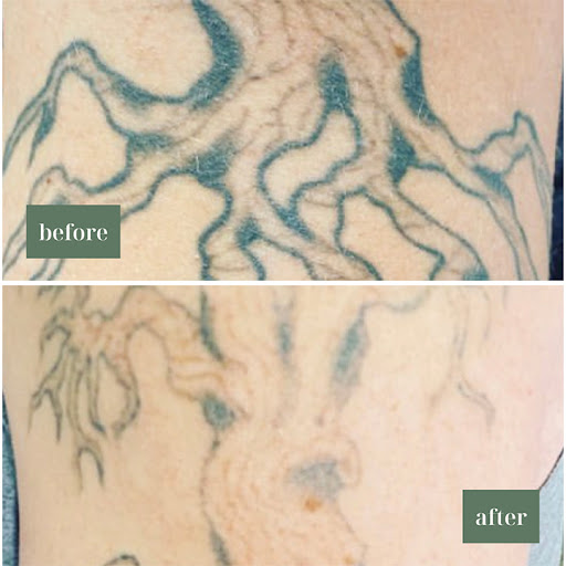 Explore mermaid tattoo ideas for females, creative tattoo ideas in Eau Claire, available at Eau Claire Body Care