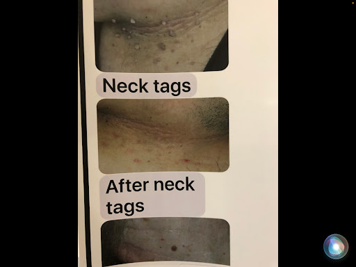 Explore edgar allan poe tattoo ideas, creative tattoo ideas in Victorville, available at Goawaytats tattoo removal