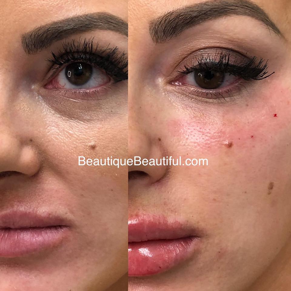 Beautique Medical Anti-Aging 37922