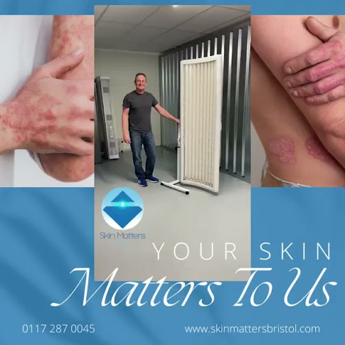 Reviews of Skin Matters Bristol in Gloucester - Carpenter