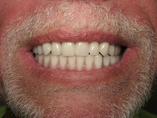 Dental implants periodontist West Jordan