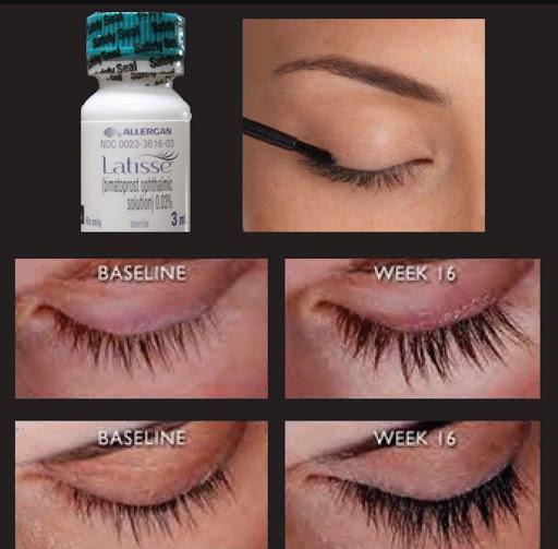 Explore rose tattoo ideas for females, creative tattoo ideas in Eugene, available at Brighter Smiles Med Spa and Laser Center