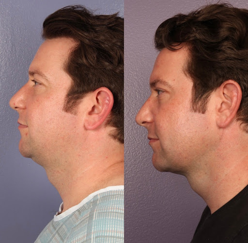 Dr. Gould Plastic Surgery image