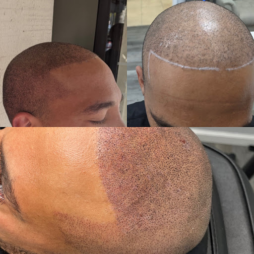 Explore tattoo ideas for siblings, creative tattoo ideas in Roseville, available at NuHair Ink. Scalp MicroPigmentation & Aesthetic Clinic of Sacramento