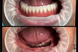Сімейна стоматологія Dr. Bessatiana - лікування зубів без болю та стресу image