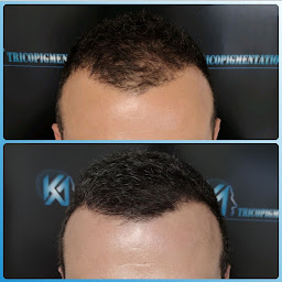 Photo n°10 de KA TRICOPIGMENTATION - Montauban / Occitanie - Pigmentation capillaire à Montauban ()