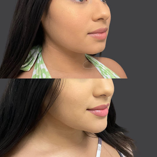 Explore melanie martinez tattoos ideas, creative tattoo ideas in Whittier, available at Skin Perfect Medical Aesthetics