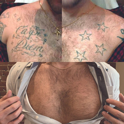 Explore disturbed tattoo ideas, creative tattoo ideas in Houston, available at Removery Tattoo Removal & Fading