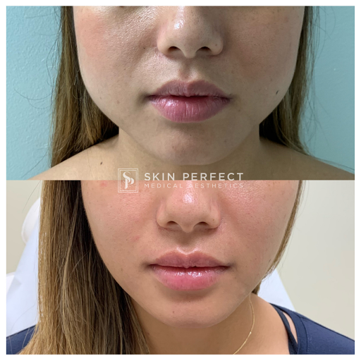 Explore pegasus tattoo ideas, creative tattoo ideas in Whittier, available at Skin Perfect Medical Aesthetics