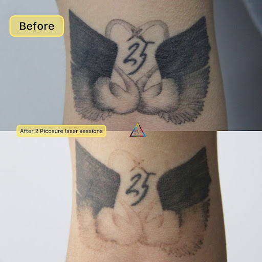 Explore pharaoh tattoo ideas, creative tattoo ideas in New York, available at Ag2g Laser Tattoo Removal & MedSpa