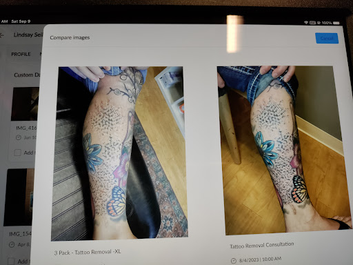 Explore hobbit tattoo ideas, creative tattoo ideas in Lawrence, available at Removery Tattoo Removal & Fading