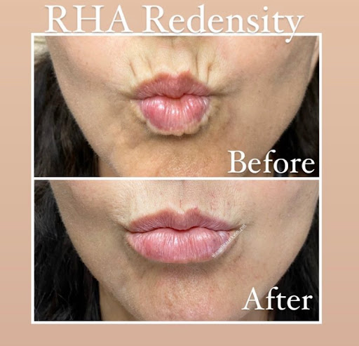 Laser Hair Removal Service «Refine Laser & Skin Care», reviews and photos, 7801 Park Dr, Chanhassen, MN 55317, USA