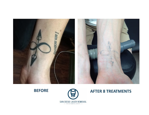 Explore tattoo book ideas, creative tattoo ideas in San Diego, available at Removery Tattoo Removal & Fading