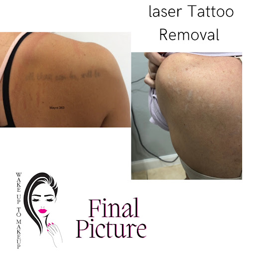 Explore ideas for henna tattoos, creative tattoo ideas in Naples, available at Laser Tattoo Removal Services