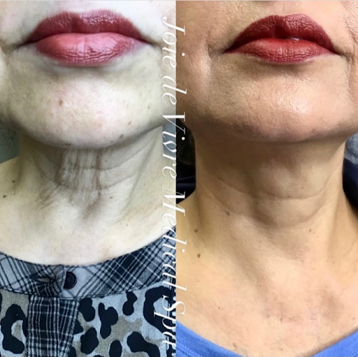 Explore hand tattoos ideas, creative tattoo ideas in Canton, available at JDV Med Spa