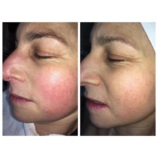 Explore torso tattoo ideas, creative tattoo ideas in Savannah, available at Haute Brows. Cosmetic Tattoo