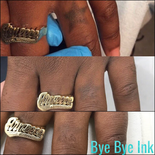 Explore tattoo ideas generator, creative tattoo ideas in Middle Village, available at Bye Bye Ink Laser Tattoo Removal