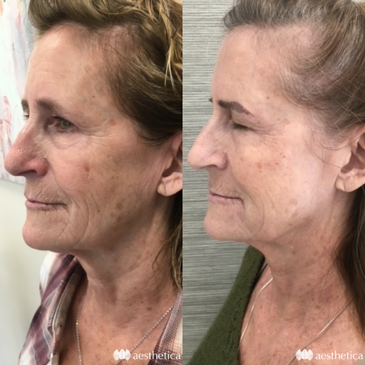 Explore patriotic forearm tattoo ideas, creative tattoo ideas in Pleasant Grove, available at Aesthetica