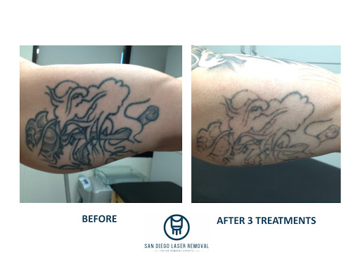 Explore star wars sleeve tattoo ideas, creative tattoo ideas in San Diego, available at Removery Tattoo Removal & Fading