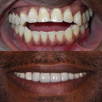 Smile Design Dental