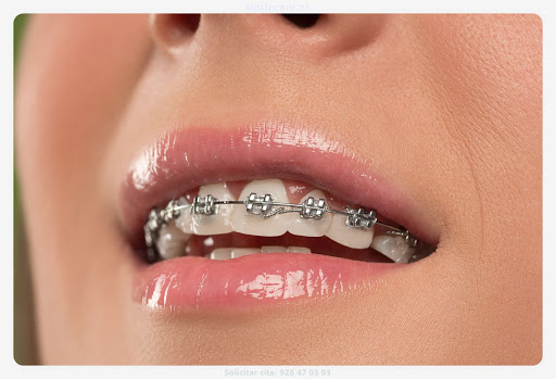 Smile Care ImplantologÍa y ortodoncia