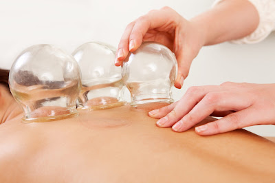 L'EQUATION DU BIEN ÊTRE, Naturopathie, Douleurs inflammatoires, Formations Hijama, Ventouses, Massage de Bien-Être à Salon-de-Provence