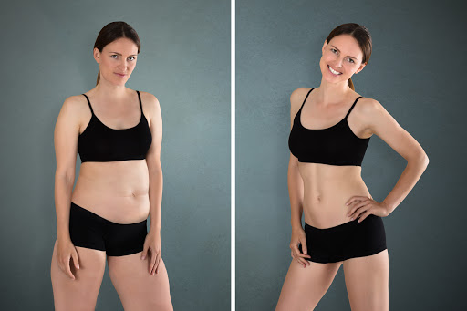 Medical Spa «A Defined Image», reviews and photos, 2330 Scenic Hwy S, Snellville, GA 30078, USA