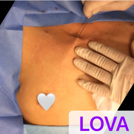 Explore stomach tattoo ideas for men, creative tattoo ideas in Lake Oswego, available at Lake Oswego Vein and Aesthetic LOVA