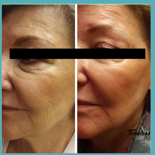 Skin Care Clinic «Timeless Laser & Skin Care», reviews and photos, 29160 Center Ridge Rd, Westlake, OH 44145, USA