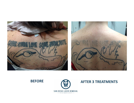 Explore tattoo ideas for women words, creative tattoo ideas in San Diego, available at Removery Tattoo Removal & Fading