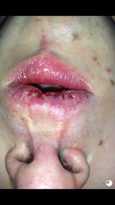 Millhouses Dental - Millhouses Dental