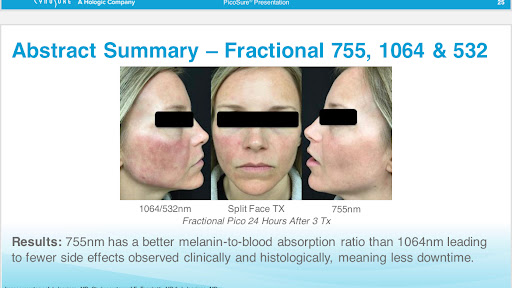 Explore front neck tattoo ideas, creative tattoo ideas in New York, available at Ag2g Laser Tattoo Removal & MedSpa