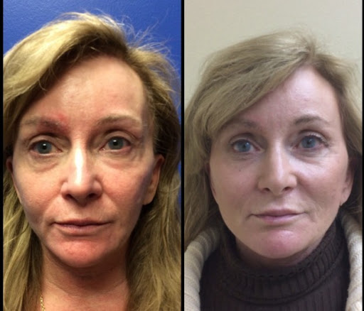 Explore landscape tattoo ideas, creative tattoo ideas in Sterling Heights, available at Skin & Vein Center