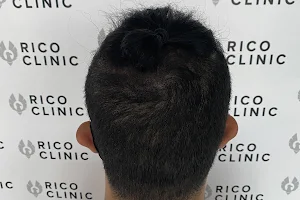 RICO CLINIC SCALP MICROPIGMENTATION MONTREAL image