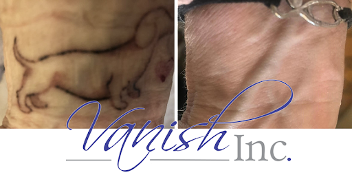 Explore boston terrier tattoo ideas, creative tattoo ideas in Williamsport, available at Vanish Laser & Skin, Inc.