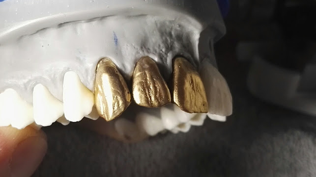 Tehnician Dentar (technicien dentaire)