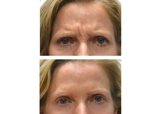 Explore stupid tattoo ideas, creative tattoo ideas in Chino, available at SoCal Body Institute